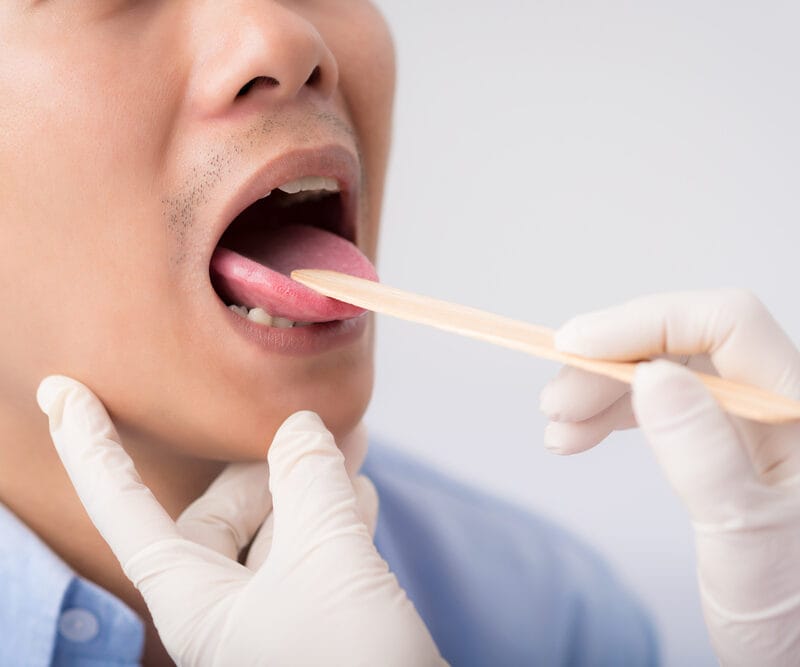 Why Does My Tongue Hurt? Causes of Sore Tongue
