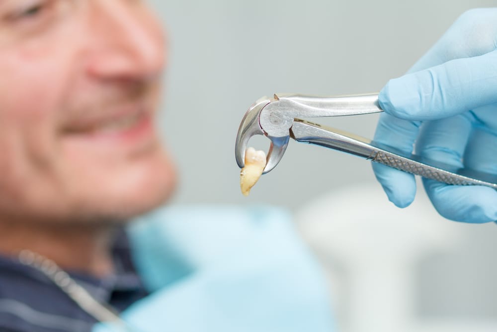 man having a dental extraction