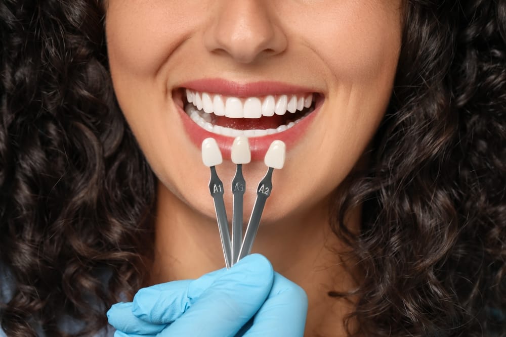 woman having a veneers