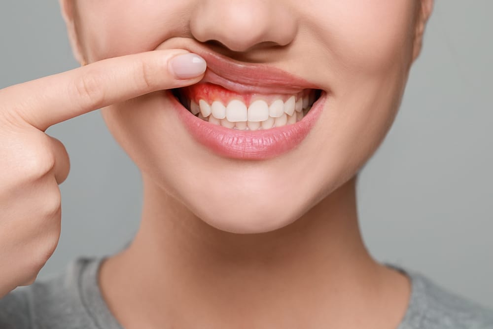 Is gingivitis contagious? 5 Common Ways Gum Disease is Spread