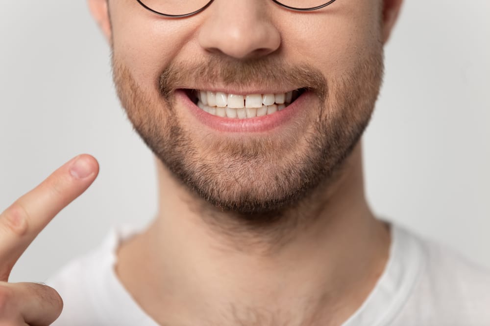 bearded man wearing glasses pointing at teeth - Root Canal Kissimmee