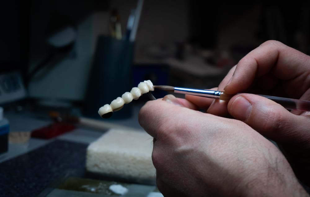 Dental Technician Crafting Teeth – Smile Haven Close-up of a dental technician’s hands carefully painting a set of dental crowns or veneers using a fine brush, with dental tools and supplies in the background – Smile Haven