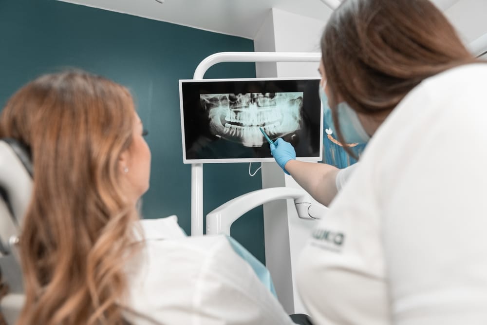 Dentist showing dental xray - Dental Implants Orlando