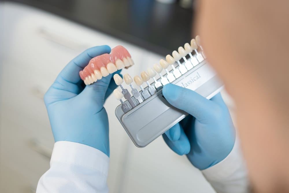 dentist checking teeth model color - Veneers