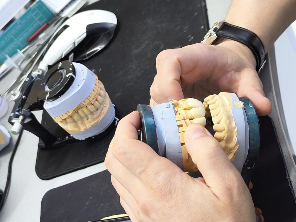 Dental Technician Adjusting Tooth Model – Smile Haven A dental technician carefully adjusts a dental model with realistic teeth molds on a black workstation, preparing it for dental restoration work – Smile Haven