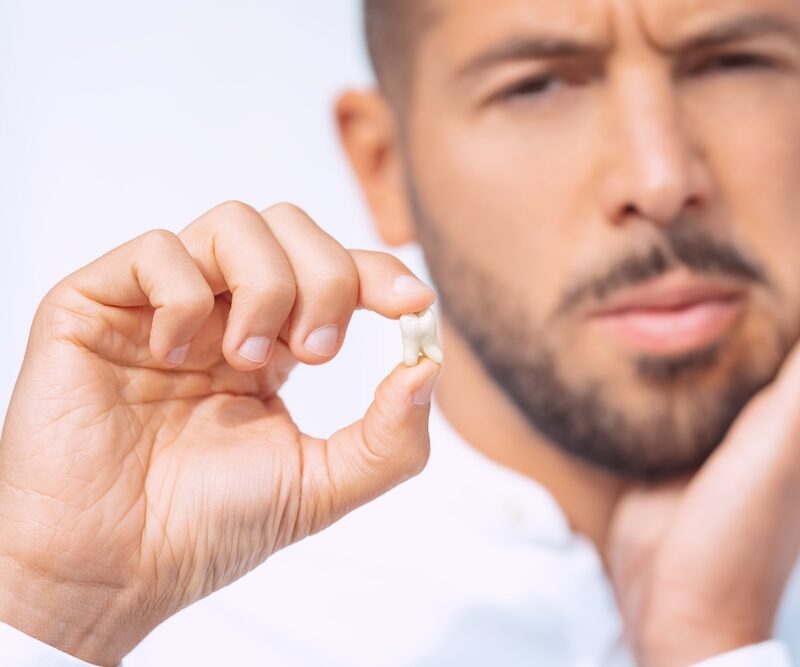 How long does wisdom teeth removal take? 4 Factors That Affect Recovery