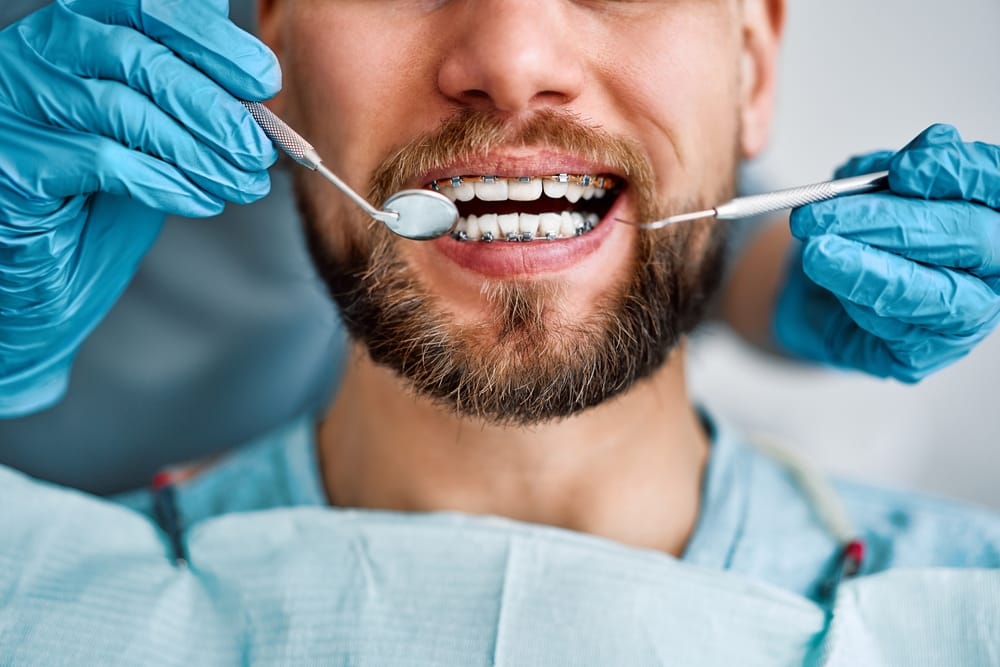 bearded man wearing braces at the dentist