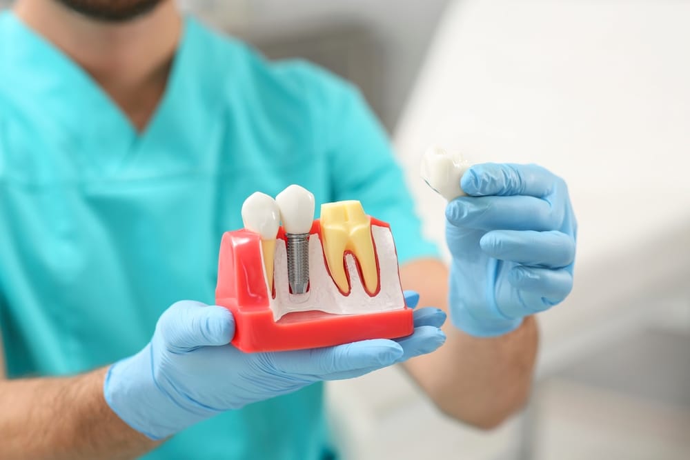 dentist showing a dental crown model
