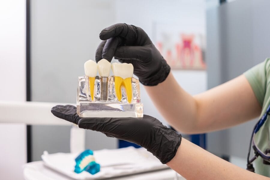 What are the 3 Types of Dental Implants? 5 Factors to Consider When Choosing Your Implant Type