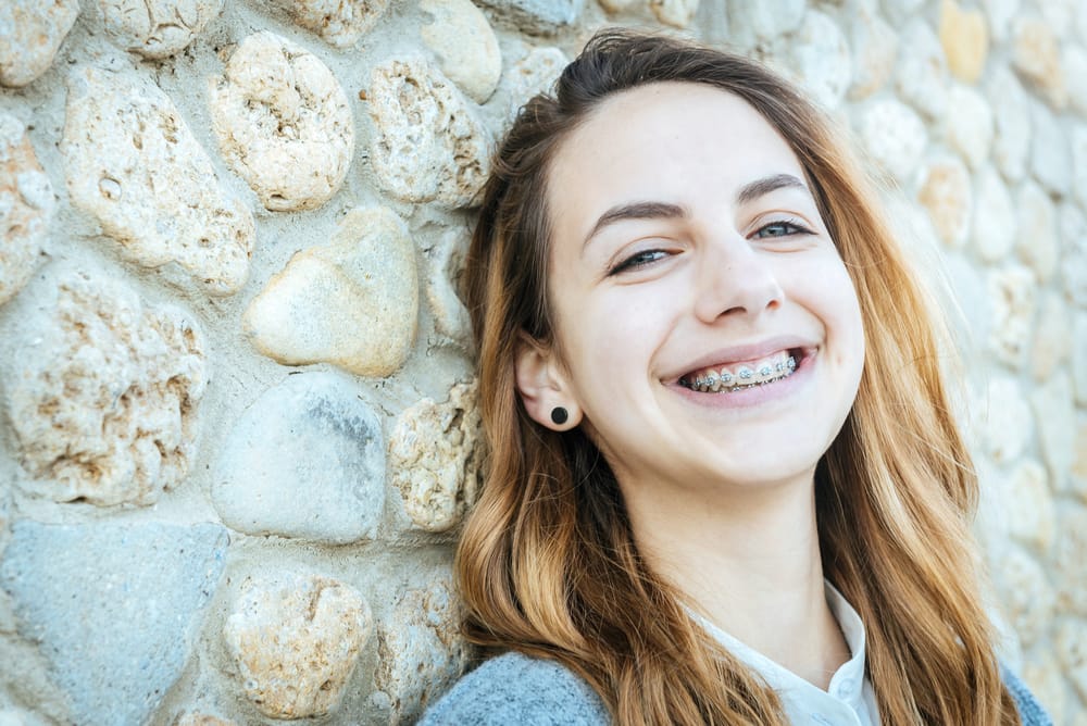 Smiling Young Woman with Braces – Smile Haven A happy young woman with long brown hair and braces smiles brightly while leaning against a stone wall – Smile Haven